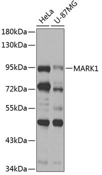 MARK1 Rabbit Polyclonal Antibody