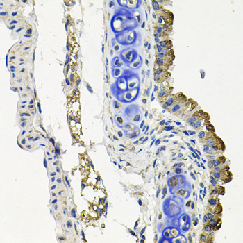 MARK1 Rabbit Polyclonal Antibody - Image 2