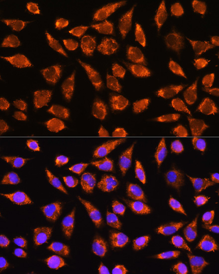 MARK2 Rabbit Polyclonal Antibody - Image 2