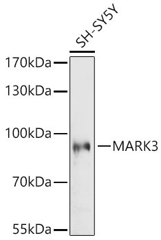 MARK3 Rabbit Polyclonal Antibody