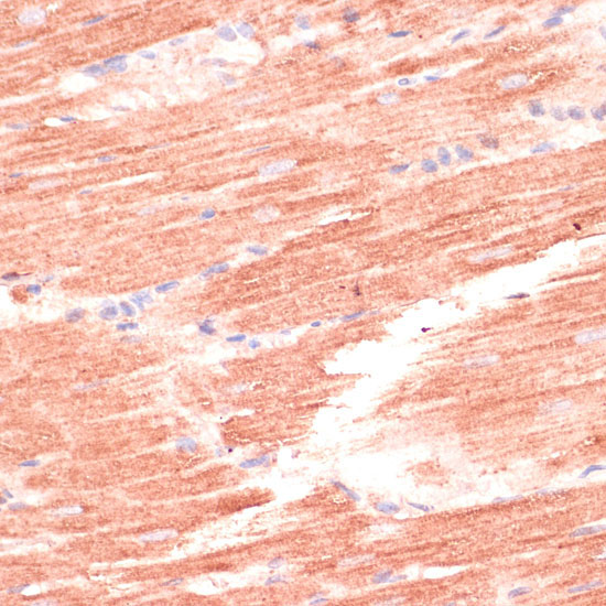 MARK3 Rabbit Polyclonal Antibody - Image 2