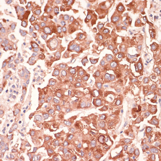 MARK3 Rabbit Polyclonal Antibody - Image 3