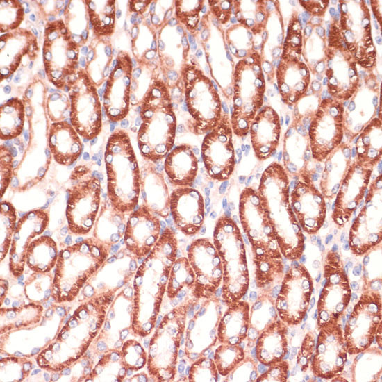 MARK3 Rabbit Polyclonal Antibody - Image 4