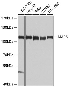 MARS Rabbit Polyclonal Antibody