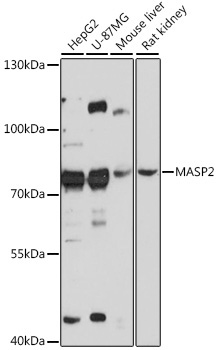 MASP2 Rabbit Polyclonal Antibody