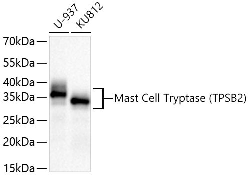Mast Cell Tryptase (TPSB2) Rabbit Monoclonal Antibody