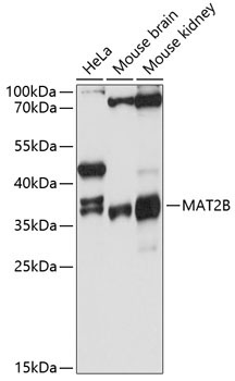 MAT2B Rabbit Polyclonal Antibody