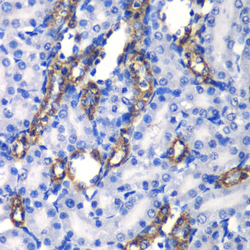MATK Rabbit Polyclonal Antibody - Image 2