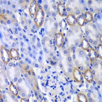 MATK Rabbit Polyclonal Antibody - Image 3