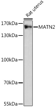MATN2 Rabbit Polyclonal Antibody