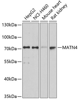 MATN4 Rabbit Polyclonal Antibody