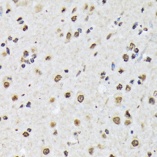 Matrin 3 Rabbit Monoclonal Antibody - Image 5