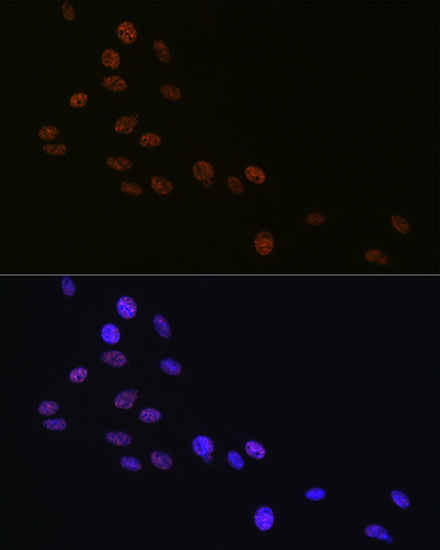 Matrin 3 Rabbit Monoclonal Antibody - Image 6