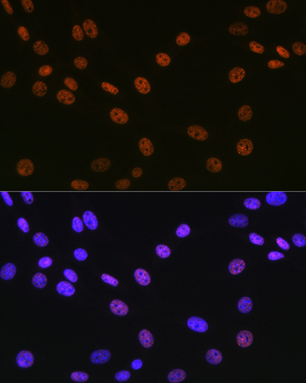 Matrin 3 Rabbit Monoclonal Antibody - Image 7