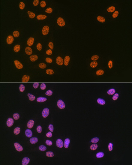 Matrin 3 Rabbit Monoclonal Antibody - Image 8