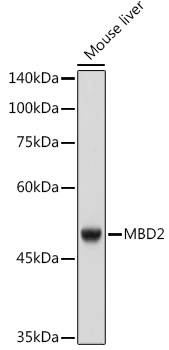 MBD2 Rabbit Monoclonal Antibody