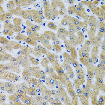 MBL2 Rabbit Polyclonal Antibody - Image 2