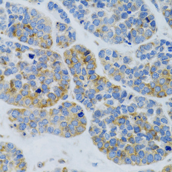 MBL2 Rabbit Polyclonal Antibody - Image 3