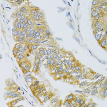 MBL2 Rabbit Polyclonal Antibody - Image 4