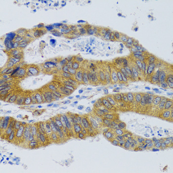 MBL2 Rabbit Polyclonal Antibody - Image 5