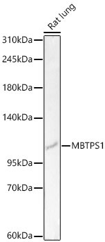 MBTPS1 Rabbit Polyclonal Antibody - Image 2