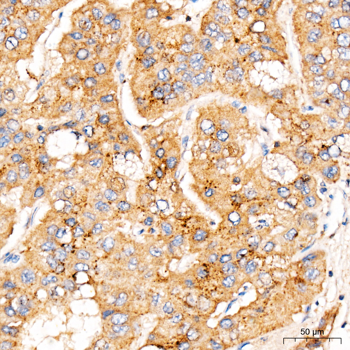 MBTPS1 Rabbit Polyclonal Antibody - Image 3