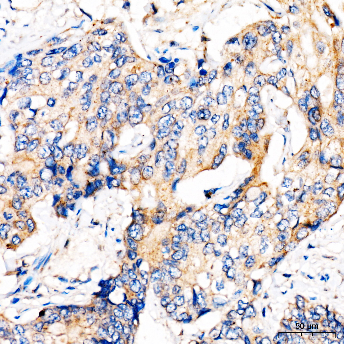 MBTPS1 Rabbit Polyclonal Antibody - Image 4