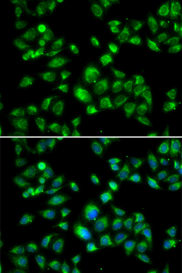 MBTPS1 Rabbit Polyclonal Antibody - Image 5