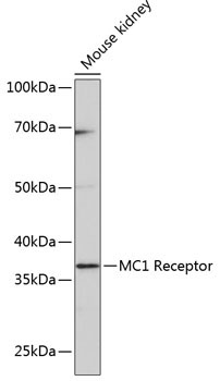 MC1 Receptor Rabbit Monoclonal Antibody - Image 2