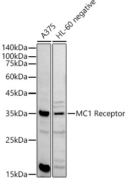 MC1 Receptor Rabbit Polyclonal Antibody