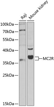 MC2R Rabbit Polyclonal Antibody