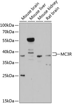 MC3R Rabbit Polyclonal Antibody