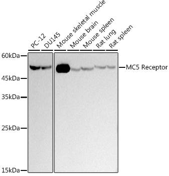 MC5 Receptor Rabbit Monoclonal Antibody