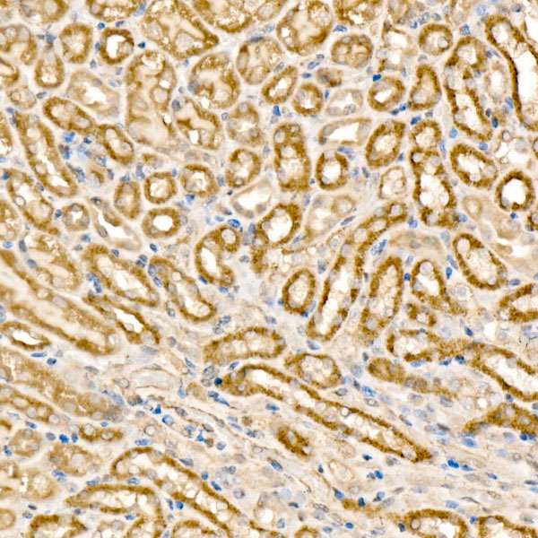 MCCC1 Rabbit Polyclonal Antibody - Image 3