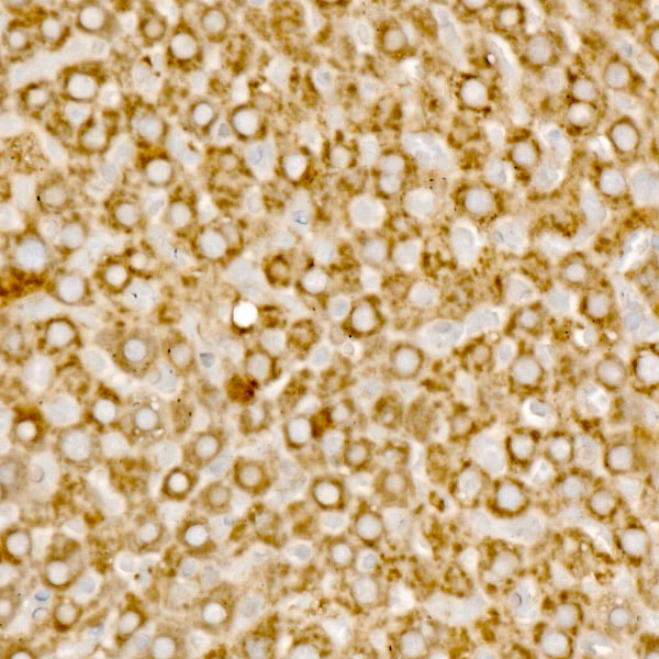 MCCC1 Rabbit Polyclonal Antibody - Image 4