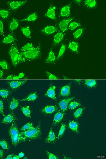 MCCC2 Rabbit Polyclonal Antibody - Image 2