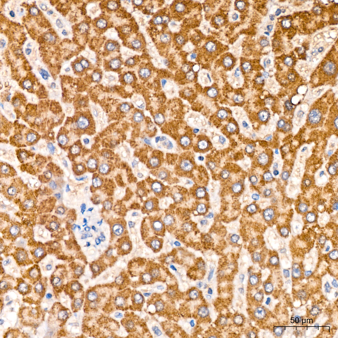 MCCC2 Rabbit Polyclonal Antibody - Image 2