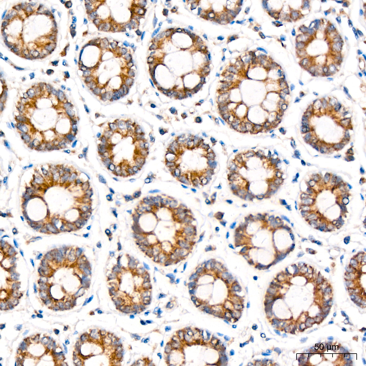 MCCC2 Rabbit Polyclonal Antibody - Image 3