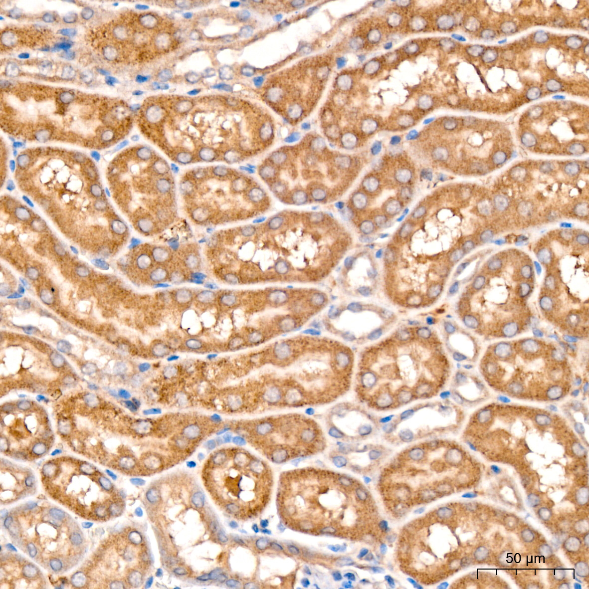 MCCC2 Rabbit Polyclonal Antibody - Image 4