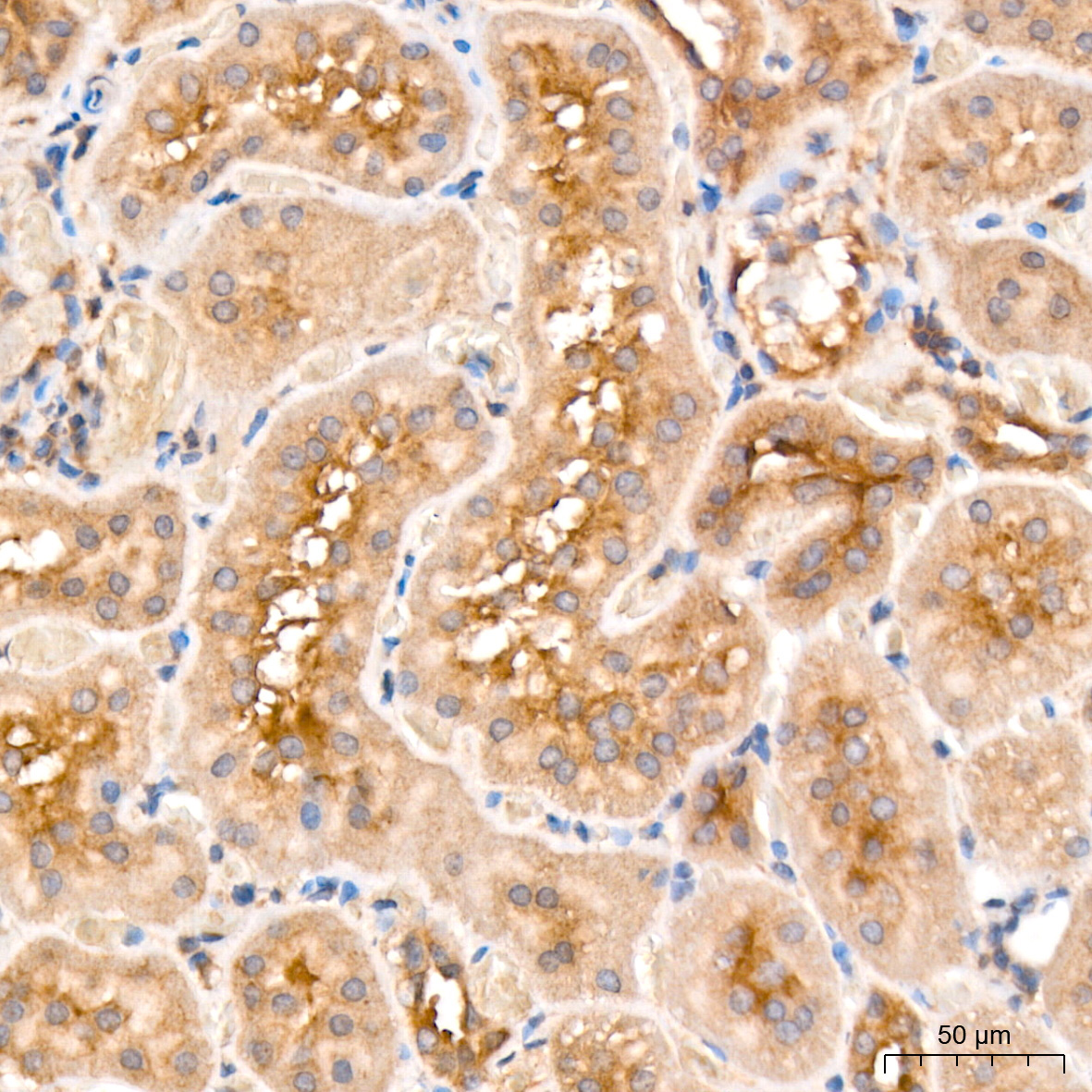 MCCC2 Rabbit Polyclonal Antibody - Image 5