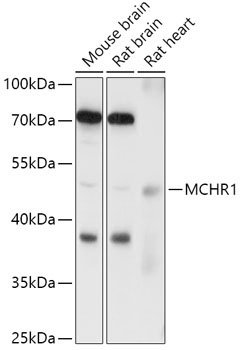 MCHR1 Rabbit Polyclonal Antibody