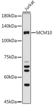 MCM10 Rabbit Polyclonal Antibody