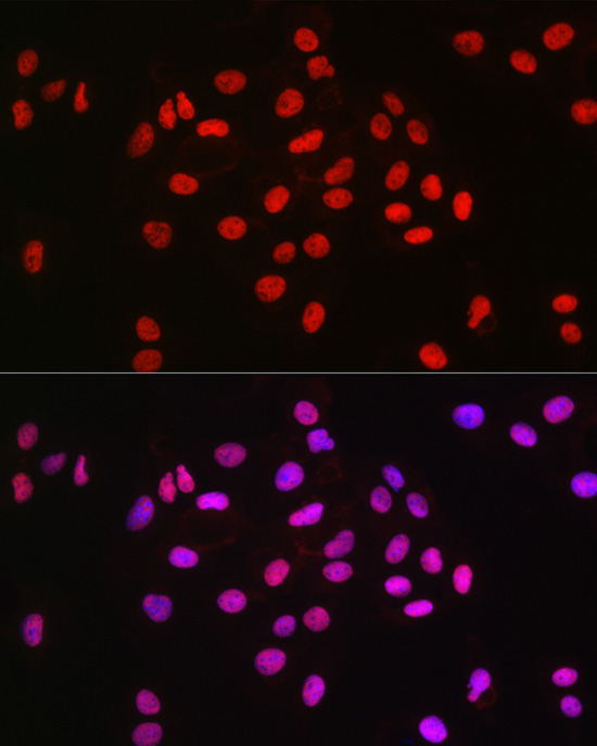 MCM2 Rabbit Monoclonal Antibody - Image 14