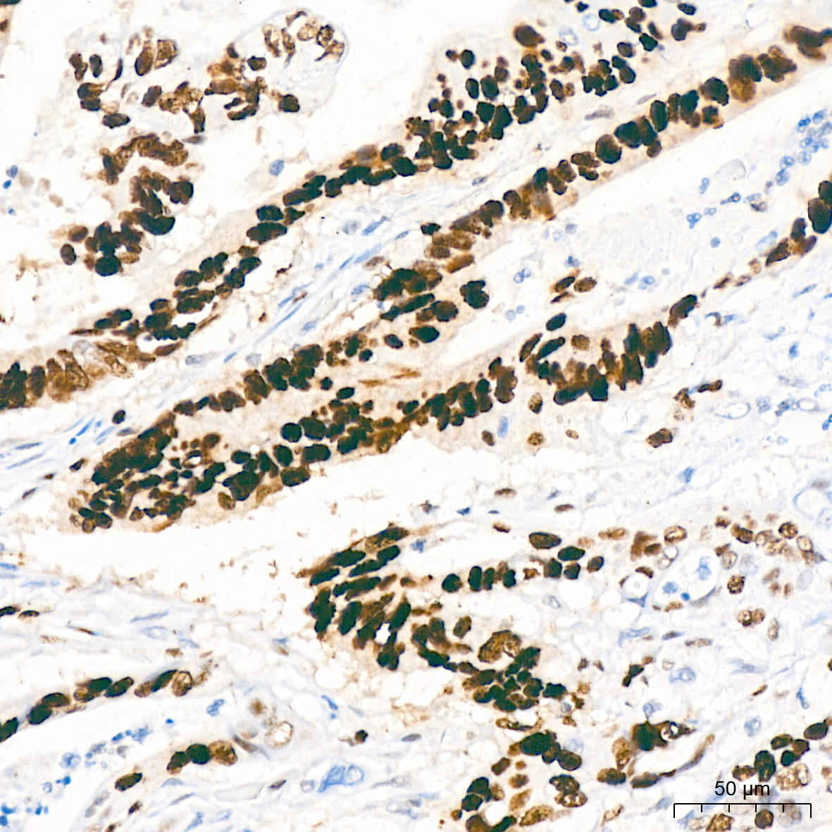 MCM2 Rabbit Monoclonal Antibody - Image 4