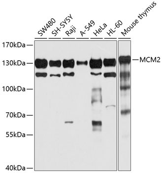 MCM2 Rabbit Polyclonal Antibody