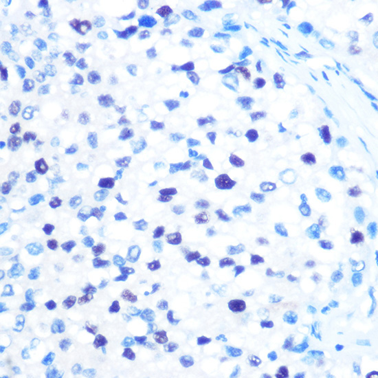MCM3 Rabbit Monoclonal Antibody - Image 3