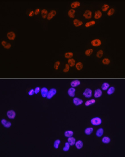 MCM3 Rabbit Monoclonal Antibody - Image 5