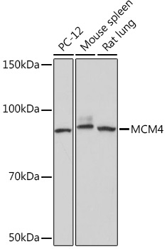 MCM4 Rabbit Monoclonal Antibody