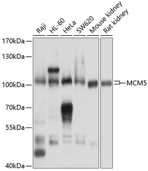 MCM5 Rabbit Polyclonal Antibody