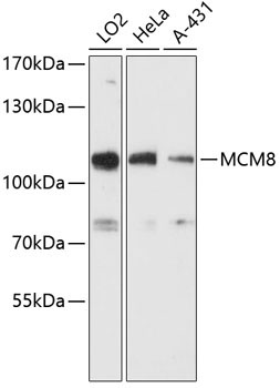 MCM8 Rabbit Polyclonal Antibody